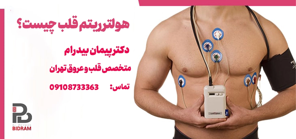 هولتر ریتم قلب چیست؟