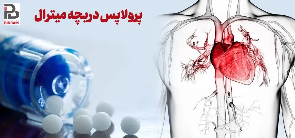 پرولاپس دریچه میترال