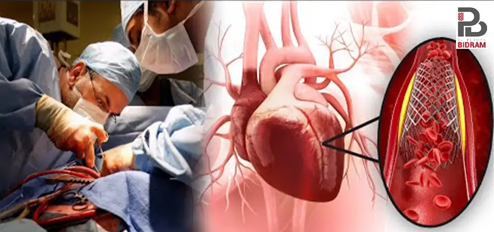 هزینه آنژیوگرافی قلب