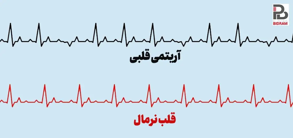 انواع آریتمی قلبی