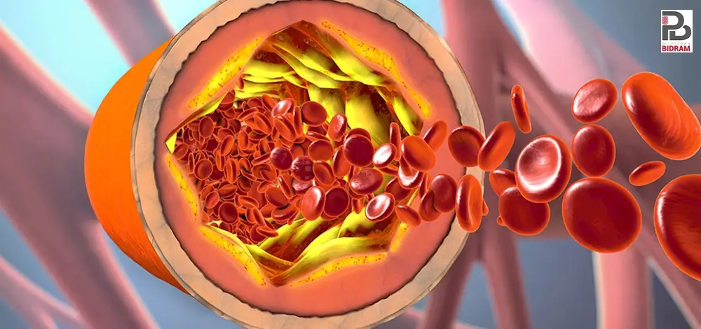 علائم آمبولی ریه