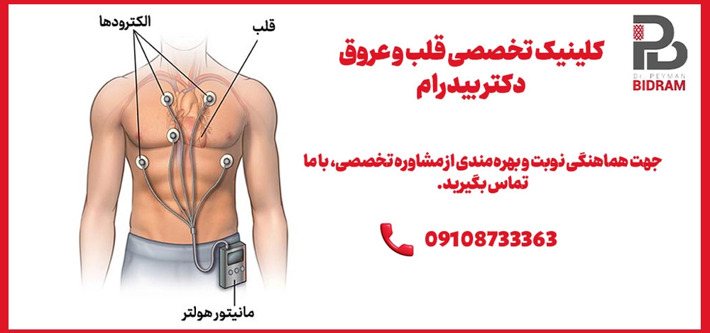 استفاده از هولتر ریتم قلب 
