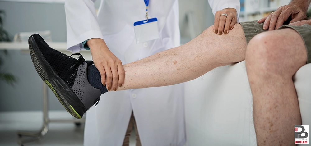 انواع واریس پا