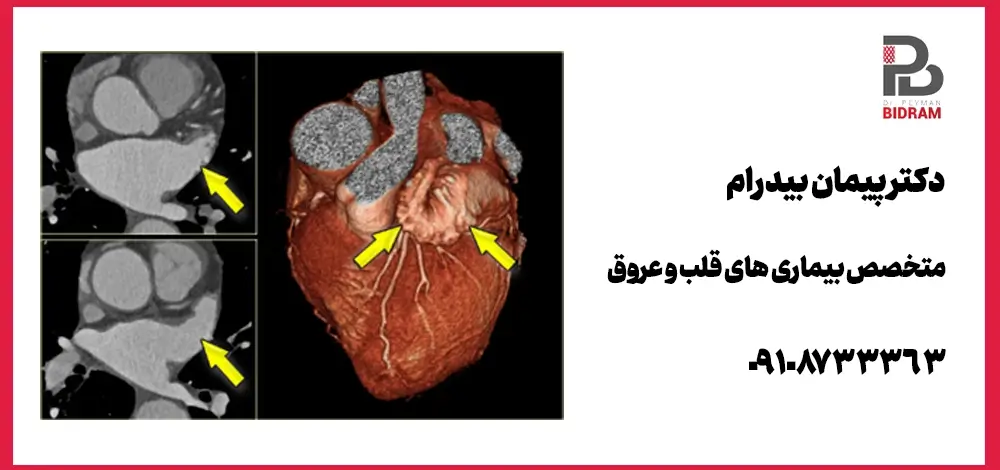 آرمایش های چکاپ قلب