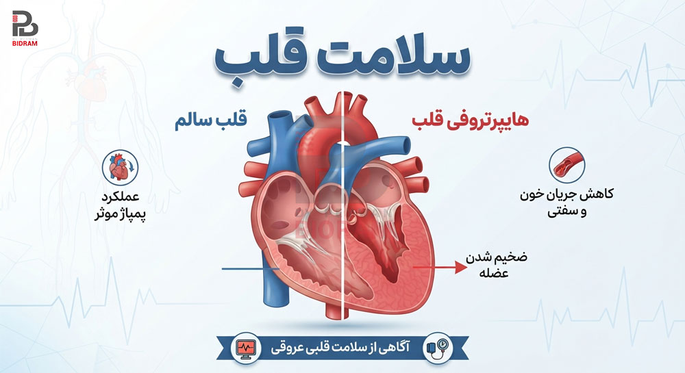 ضخیم شدن دیواره قلب